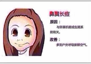 鼻子长痘痘的原因 对症下药狙击鼻头痘