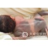 孩子多大可以治疗太田痣