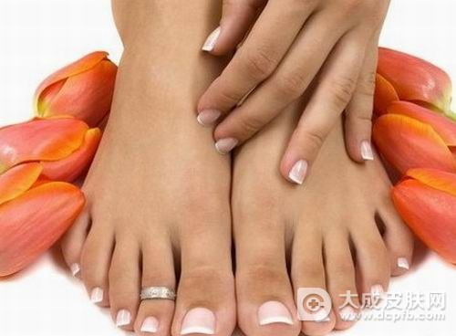 手脚爱出汗 小心得多汗症