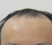 好习惯让你远离脱发困扰