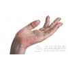 怎么做可以预防湿疹