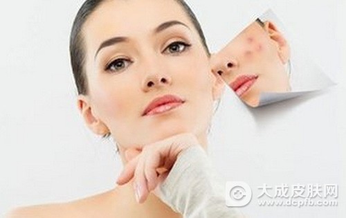 左脸颊长痘的原因是什么 长痘怎么办