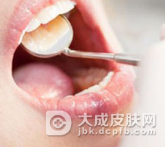口腔粘膜病的预防方法