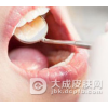 口腔粘膜病的预防方法