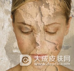 秋季皮肤干燥怎么办 如何保养肌肤