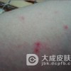 口水也能检测艾滋病你知道吗