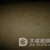 介绍艾滋病的传播方式