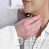 咽炎的病因是什么