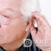 耳部带状疱疹的症状表现
