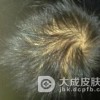如何控制脂溢性脱发的油脂分泌