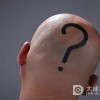 男性脱发的最终原因