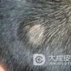 斑秃会给患者带来哪些危害呢