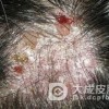 日常生活中头癣饮食需要注意什么呢