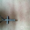 引发接触性皮炎的病因