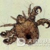女性预防阴虱病的4种方法