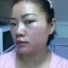 哪些因素会导致皮肤过敏的出现