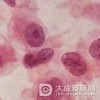 为什么老年人会得老年瘙痒症呢