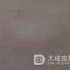 青少年白癜风的临床症状有哪些？