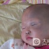 什么原因导致了太田痣