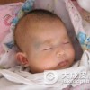 太田痣什么颜色好治