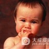 小孩子起痱子怎么办