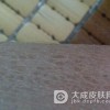 鱼鳞病在生活中我们该如何护理