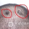 哪些因素会导致头癣的病发呢