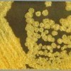 糠秕孢子菌毛囊炎常见病因是哪些