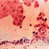 天疱疮吃什么好