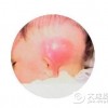 患大疱性类天疱疮的病因是什么