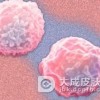 热性嗜中性白细胞皮肤病的早期表现