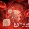 如何预防外阴溃疡？