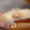 营养不良性皮肤钙化病如何预防
