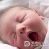 新生儿生理性黄疸怎么办？