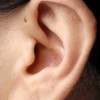 遗传性耳瘘如何预防