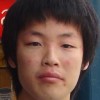小儿面部红斑侏儒综合征的症状有哪些