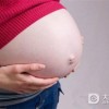 孕妇如何防治妊娠合并淋病