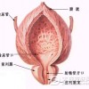 男性预防前列腺炎要注意什么