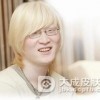 白化病到底会不会传染呢