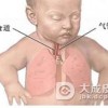 小儿色素失调症病因是什么