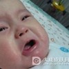 油彩皮炎应该怎样预防