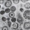 得了非淋菌性尿道炎有何体现