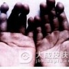 趾断症有哪些治疗措施