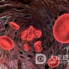 特发性血小板减少性紫癜的饮食怎么办