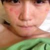 皮肤过敏的根本原因是什么呢
