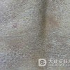 得了鱼鳞病要怎么办才好呢