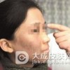 黑变病致病的因素分析