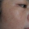 黑变病出现的众多原因