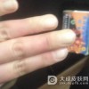 皮肌炎患者的日常生活护理措