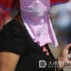 日光性皮炎会不会遗传